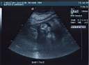 071004Ultrasound.jpg